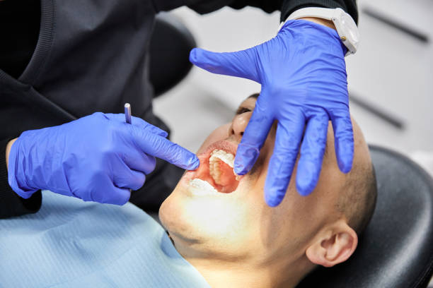 Best Knocked-Out Tooth (Avulsed Tooth) Treatment in Morgantown, KY